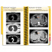 MDpocket Radiology & Imaging